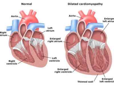 Grain Free Diets linked to Dilated&nbsp;Cardiomyopathy